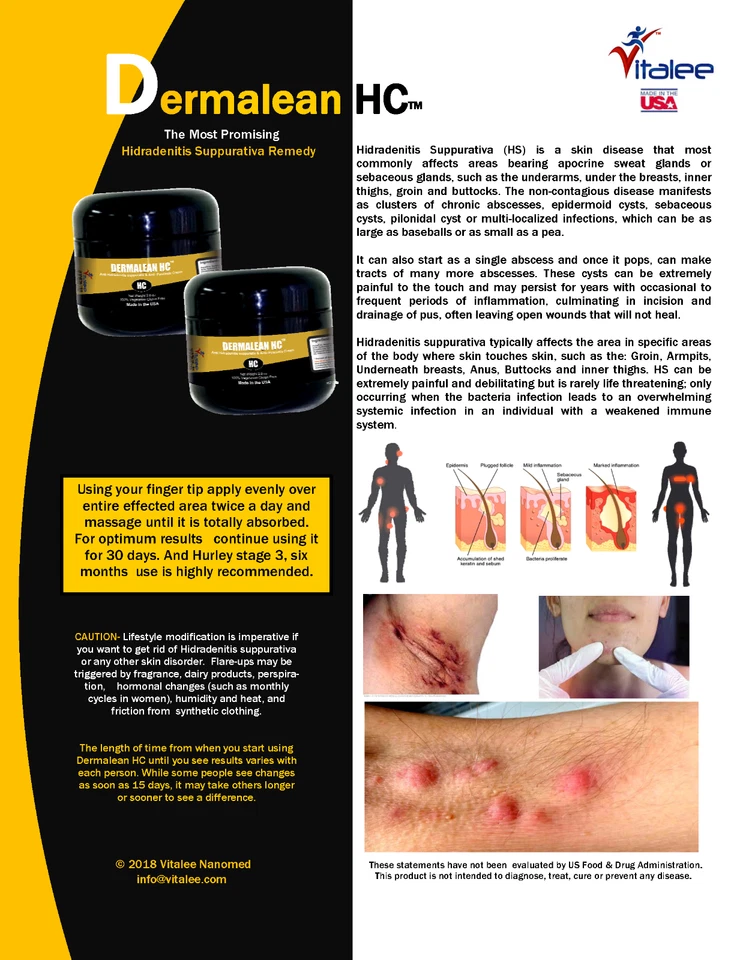 Dermalean HC-Hidradenitis Supurativa Piel HS Crema Remedio Glándula Apocrina (2 Oz) - Imagen 2 de 4