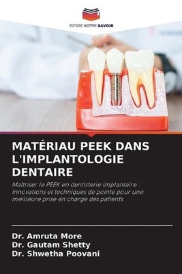 Matriau Peek Dans l'Implantologie Dentaire by Dr Amruta More Paperback Book