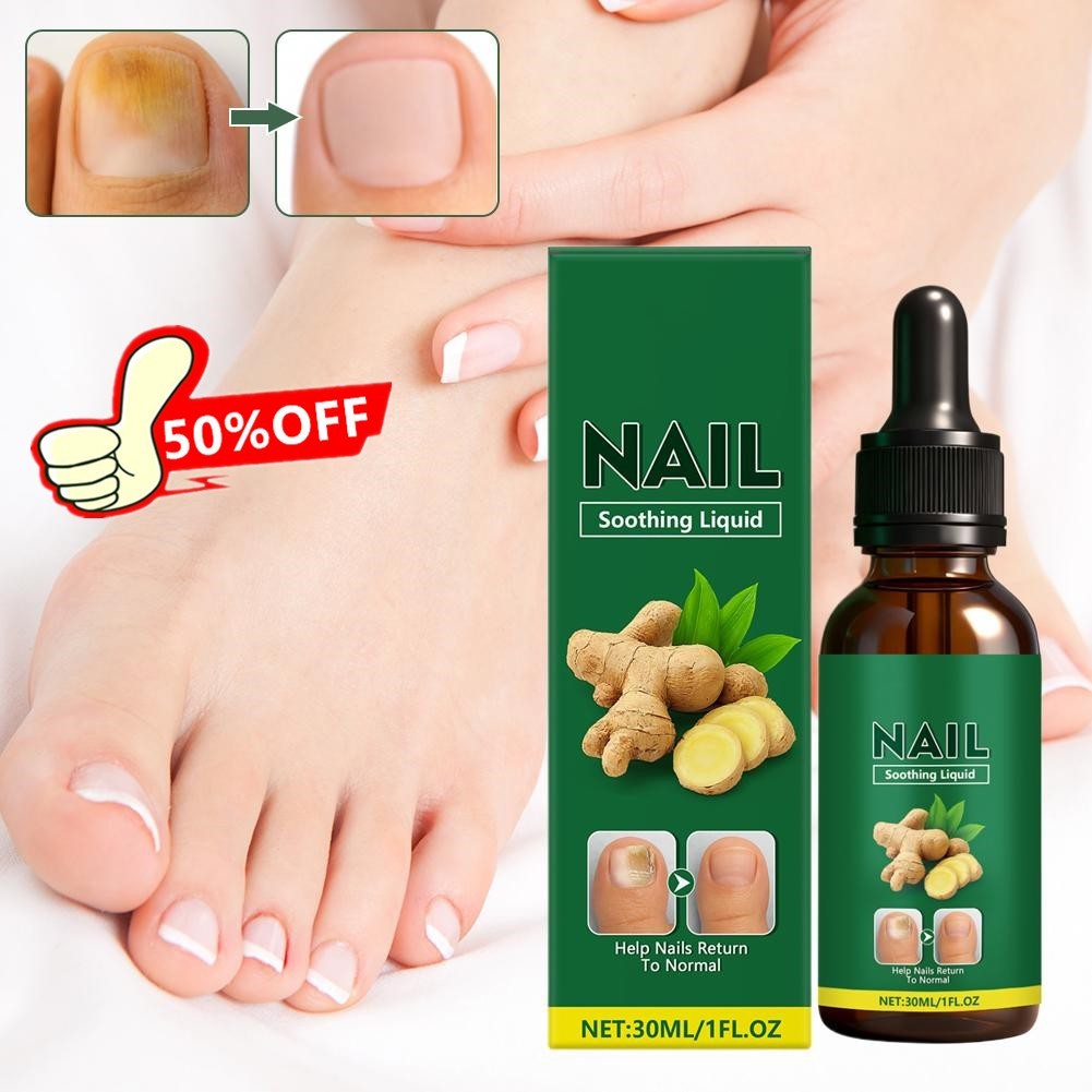 Ginger Nail Care Solution, Nail Soothing Liquid Help NEW Return Nails to Y2D1