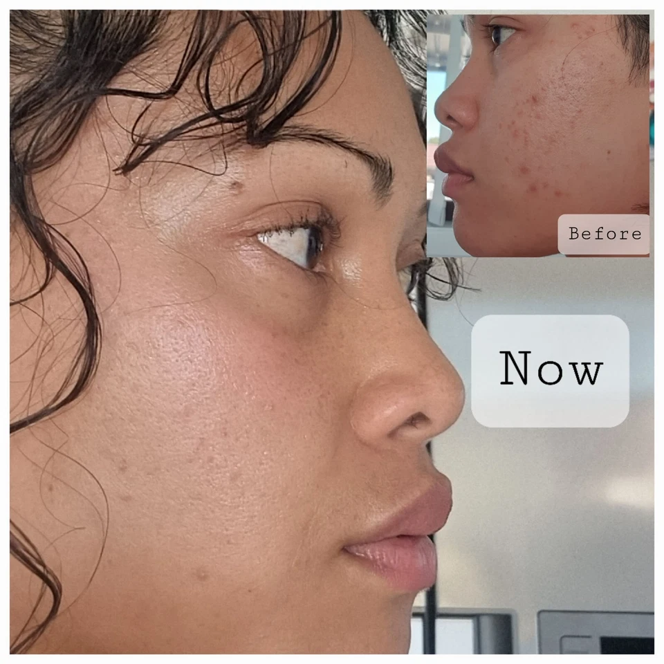 Pure 100% Tallow. Rendered Beef Tallow. Unwhipped Unscented. Cooking Tallow. - image 3 of 4