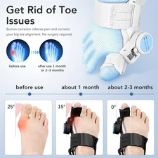 Bunion Corrector for Women & Men | Adjustable Toe Straightener for Pain Relief