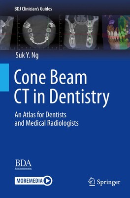 Suk Y. Ng | Cone Beam CT in Dentistry | Taschenbuch | Englisch (2024) | xv