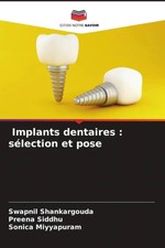 Swapnil Shankargouda (u. a.) | Implants denta...