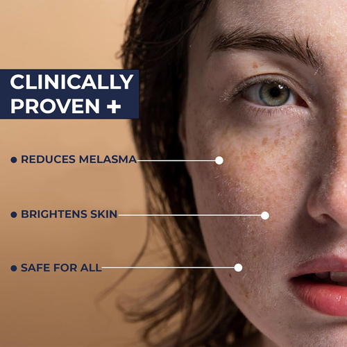 Melasma Treatment for Face - Melasma Cream & Age Spot Remover for Skin Discolora - Picture 5 of 12