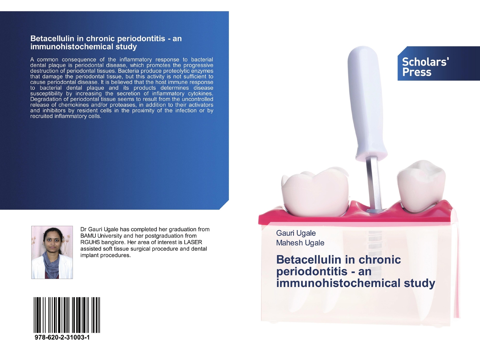 Betacellulin In Chronic Periodontitis - An Immunohistochemical Study