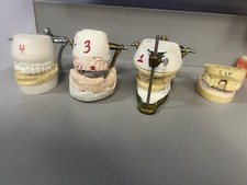 Vintage Adjustable Dental Articulator with model. Great for teaching !!