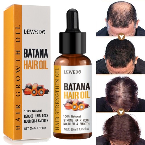 Batana Oil Serum for Hair Growth Hair Loss Treatment Men & Women Hair Care 50ML