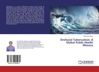 Orofacial Tuberculosis: A Global Public Health Menace Shamimul Hasan Taschenbuch