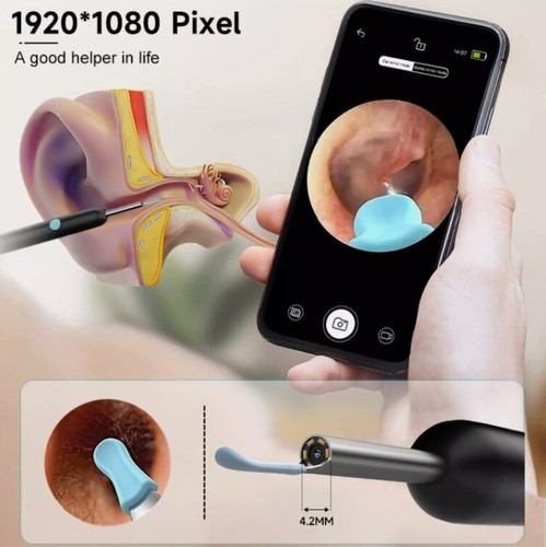 HD LED Ear Camera Otoscope With Wax Removal Tools For Kids And Adults 9 thumbnail image