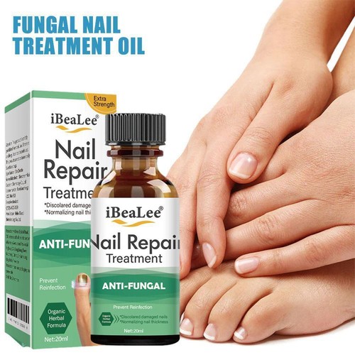 Nail Fungus Removal Cream Anti Fungal Foot Nails Repair CDE-~ Ointment X4V9 - Picture 9 of 11