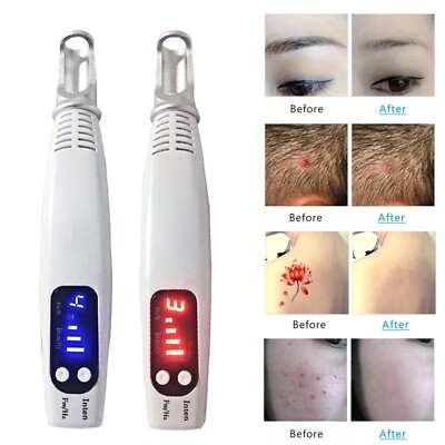 Blu-Ray Pikosekunden Laser Tattoo Entfernung Stift Maulwurf Dot Mole Entferner