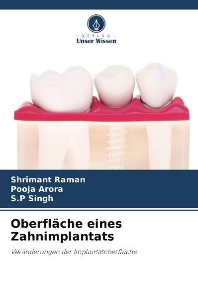 OberfläChe Eines Zahnimplantats S. P Singh-image