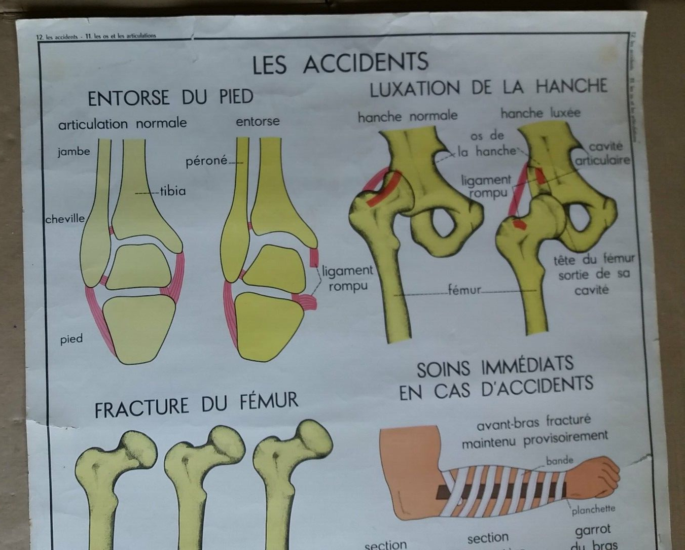 Affiche Scolaire Vintage Rossignol - Hôpital Et Cueillette De Champignons