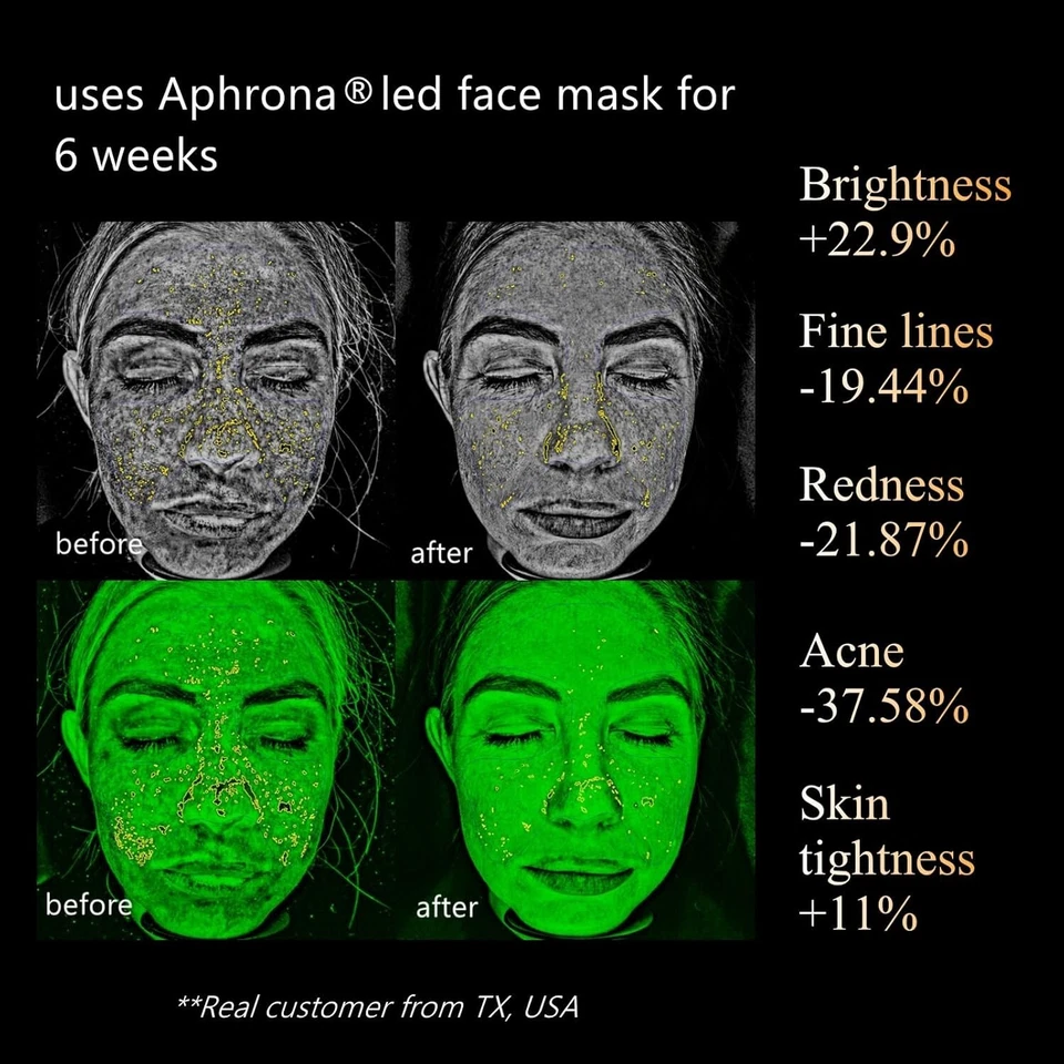 Aphrona Led Face Mask Light Therapy Halo Led Light Therapy Facial & Neck Skin - Image 3 of 4
