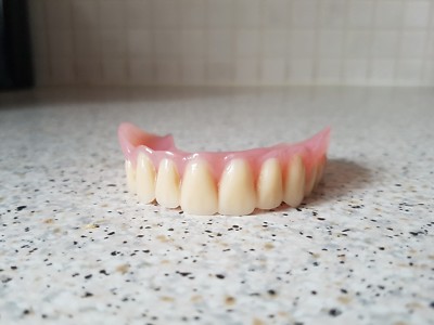 Teilprothese Für Die Zähne: Arten, Befestigung, Kosten