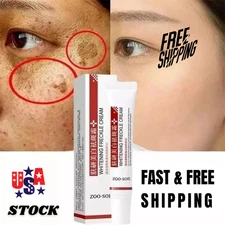 Effective Whitening Freckle Cream Remove Dark Spot Cream Removal Melanin Melasma