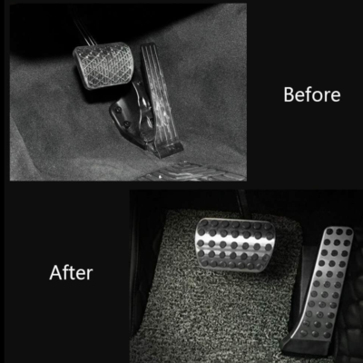 Accelerator Brake Foot Rest Pedal For Mercedes-Benz C E S W GLK CLS SLK AMG SL e