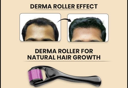 Derma Skin Roller Hair Loss Beard 540 Titanium Microneedle Acne Scars - Picture 5 of 17