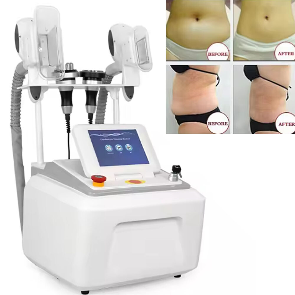【大幅値下げ】脂肪冷却マシン　Cryolipolysis Amazon.co.jp: Cryolipolysis 脂肪凍結痩身マシン、8 in 1 360