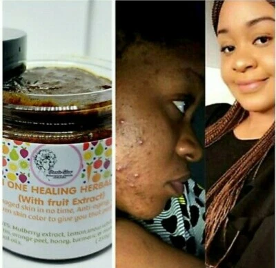 Whitening Herbal Black Soap (ALL IN ONE) 300g