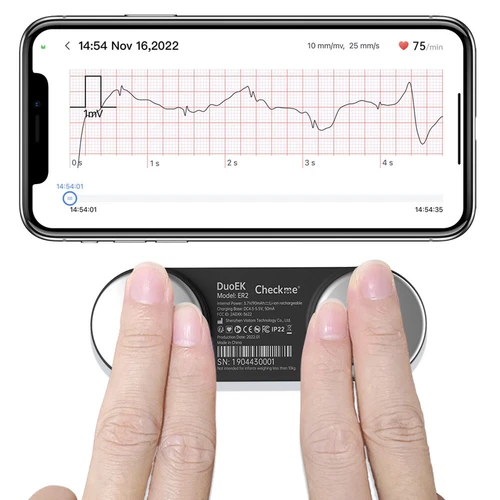 ECG EKG Heart Monitor - Smartphone compatible free AI ECG Analysis Detects AFib - Picture 1 of 13