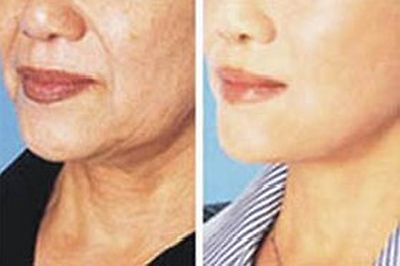 4 Day Sample to See Effect! Remove Wrinkle Anti-Ageing Concentrated Herb Powder