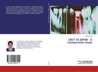Cbct VS Iopar - A Comparative Study Pallavi Sinha
