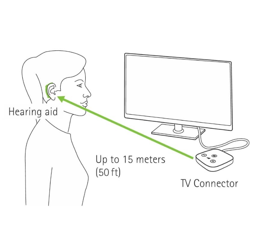 GENUINE Phonak Audéo M Marvel P Paradise L Lumity Hearing Aid 4.0 Domes GENUINE Phonak Audéo M Marvel P Paradise L Lumity Hearing Aid 4.0 Domes