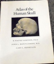 Atlas Human Skull Forensic Anthropology Grave Autopsy CSI Crime Freak Morgue DA