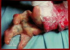 X-FILES - SEASON ONE - Card #61 - JOHN BARRETT'S HAND - Topps - 1996