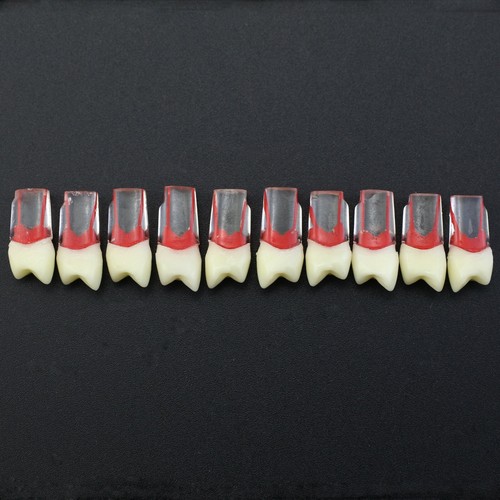10PCS Kilgore Nissin Type Dental Root Canal Teeth Model For Endo Study Practice - Picture 6 of 80