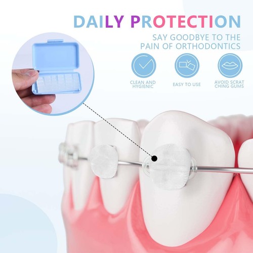 Cera Protettiva Braces Colorata – Confezione da 12 Soluzioni Sollievo Dentale Ipoallergenico - Foto 7 di 9
