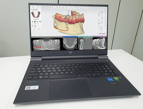 3shape 2023 software. vollmodul. (inlab, exocad etc.) - Bild 3 von 3