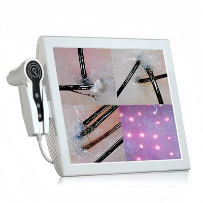Professional 15-Inch Scalp Camera for Beauty Salons   High-Resolution Hair an...