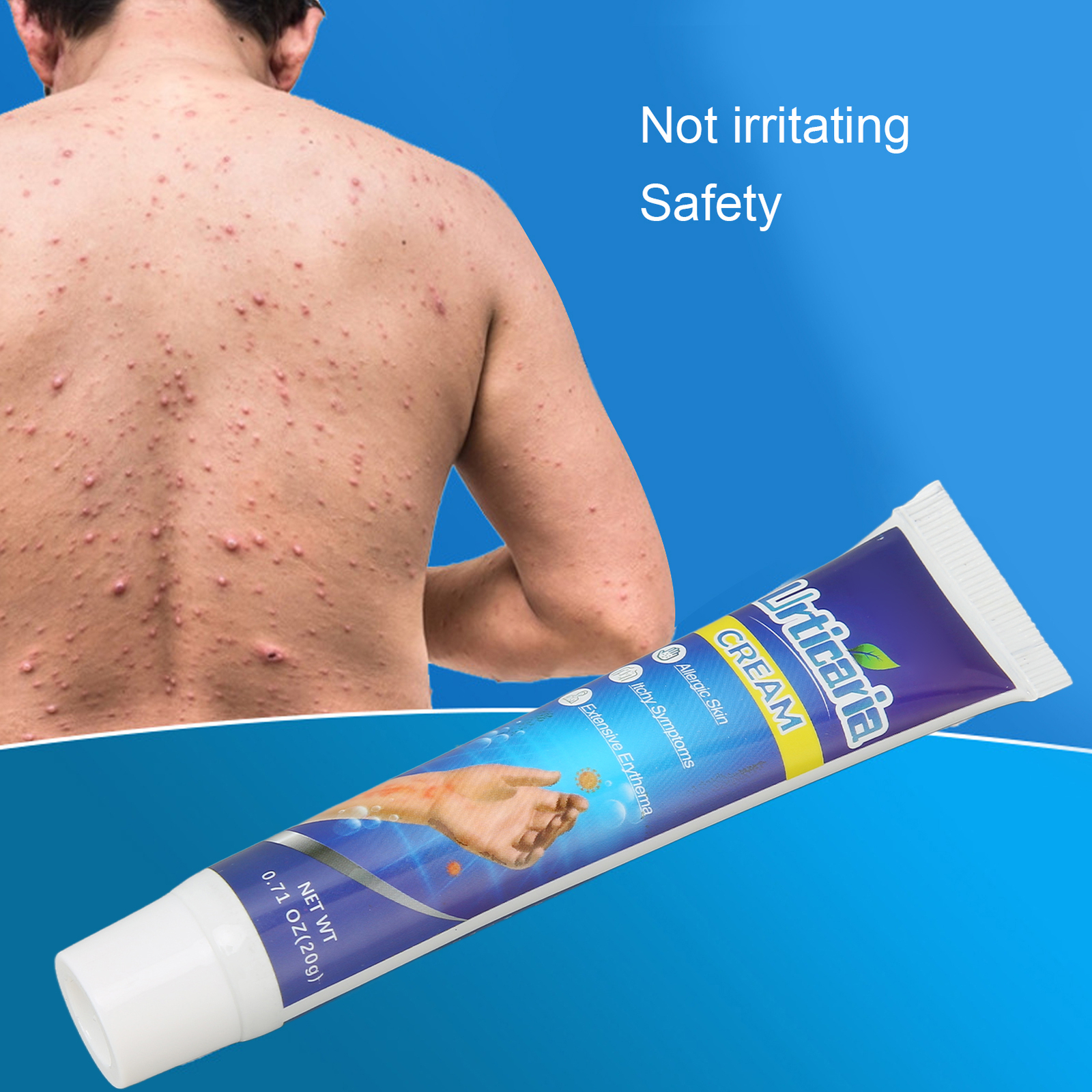 Pruritus Treatment Urticaria Cream Face Care Natural Ointment Body