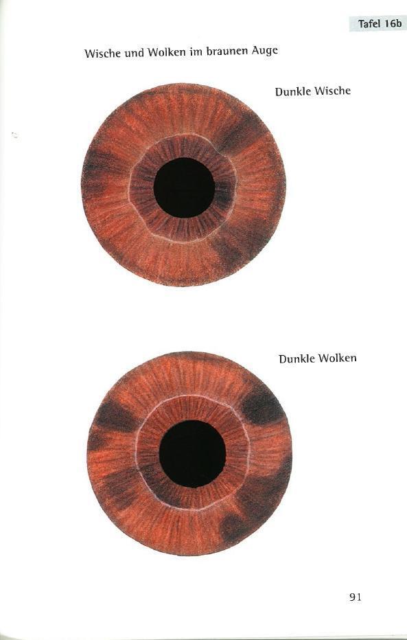 Thumbnail - Repertorium Der Irisdiagnose Joachim Broy Buch 638 S. Deutsch 2016