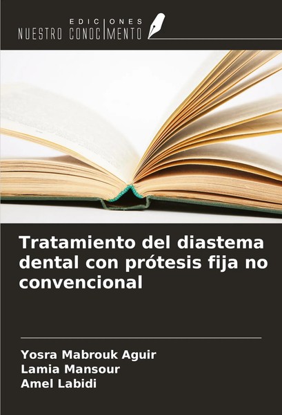 Tratamiento Del Diastema Dental Con PróTesis Fija No Convencional Aguir (U. A.)-image