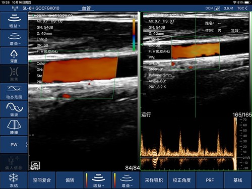 Doppler a colori lineare palmo portatile scanner a ultrasuoni sistema di imaging portatile - Foto 4 di 5