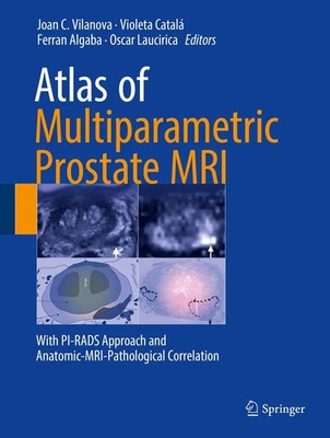Atlas of Multiparametric Prostate MRI | Joan C. Vilanova (u. a.) | Buch | xi