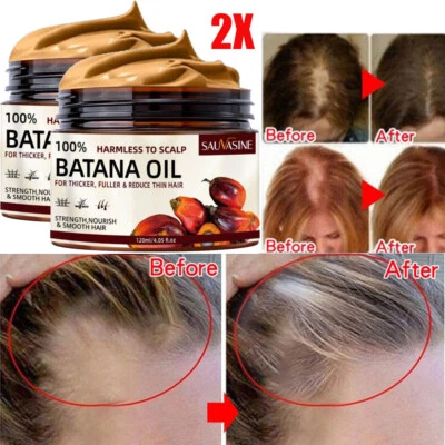 SAUVASINE 2PACK Batana Hair Loss Oil Conditioner Nourish Scalp Batana Oil for Hair Growth