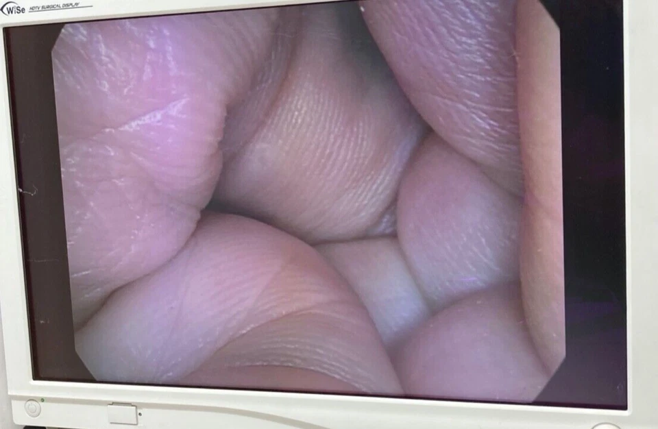 Smith & Nephew Dyonics 72202463 10 mm x 0 ° x 330 mm HD Laparoscopio Autoclavable Foto 2 de 4