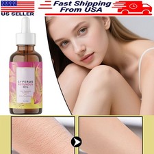 NEW Cyperus Rotundus Oil - 60ml Natural Cyperus Rotundus Oil For Hair Removal