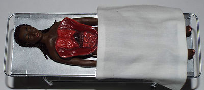 Doll miniature handcrafted Medical Hospital Asylum Morgue Autopsy body 1//12th