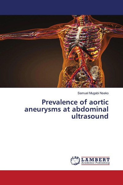 Samuel Mugabi Nseko | Prevalence Of Aortic Aneurysms At Abdominal Ultrasound-image