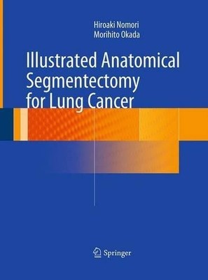 Illustrated Anatomical Segmentectomy for Lung Cancer - 9784431561217