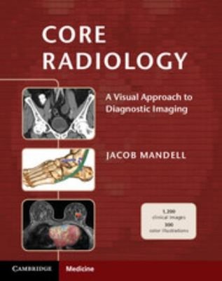 Core Radiology: Ein Visuelles Ansatz Zu Diagnostisch Imaging Jacob