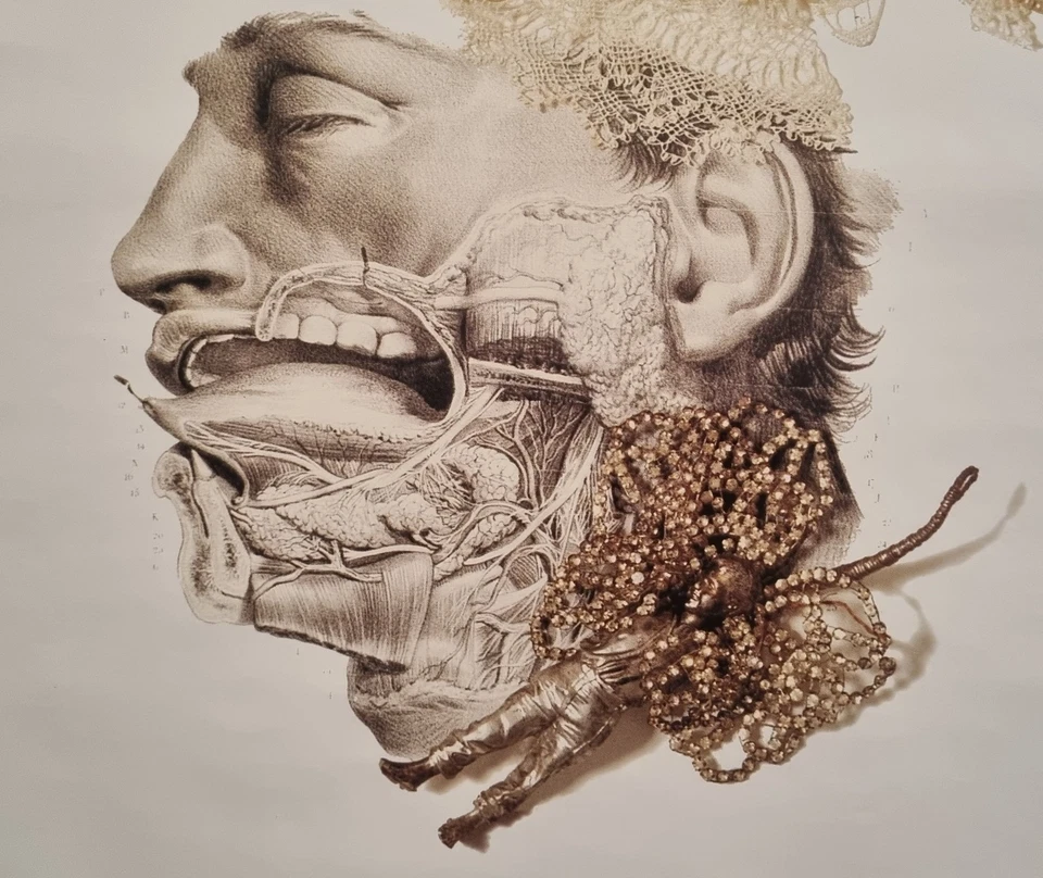 Daniel Spoerri - Serigrafia firmata e numerata - Edizione soli 10 esemplari - Immagine 3 di 4