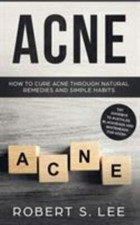 Acne: How to Cure Acne through Natural Remedies and Simple Habits. Say Goodby...