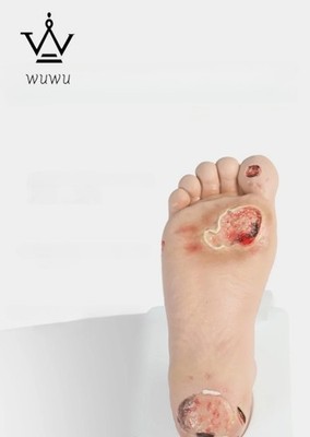 Diabetic Foot Care Model PVC Material for Medical Science Teaching
