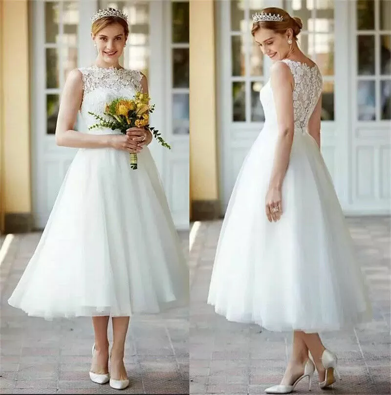 Medium length top wedding dresses